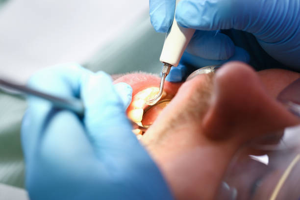 Best Emergency Treatment for Oral Infections in Quitman, MS