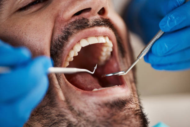 Best Emergency Root Canal Therapy in Quitman, MS